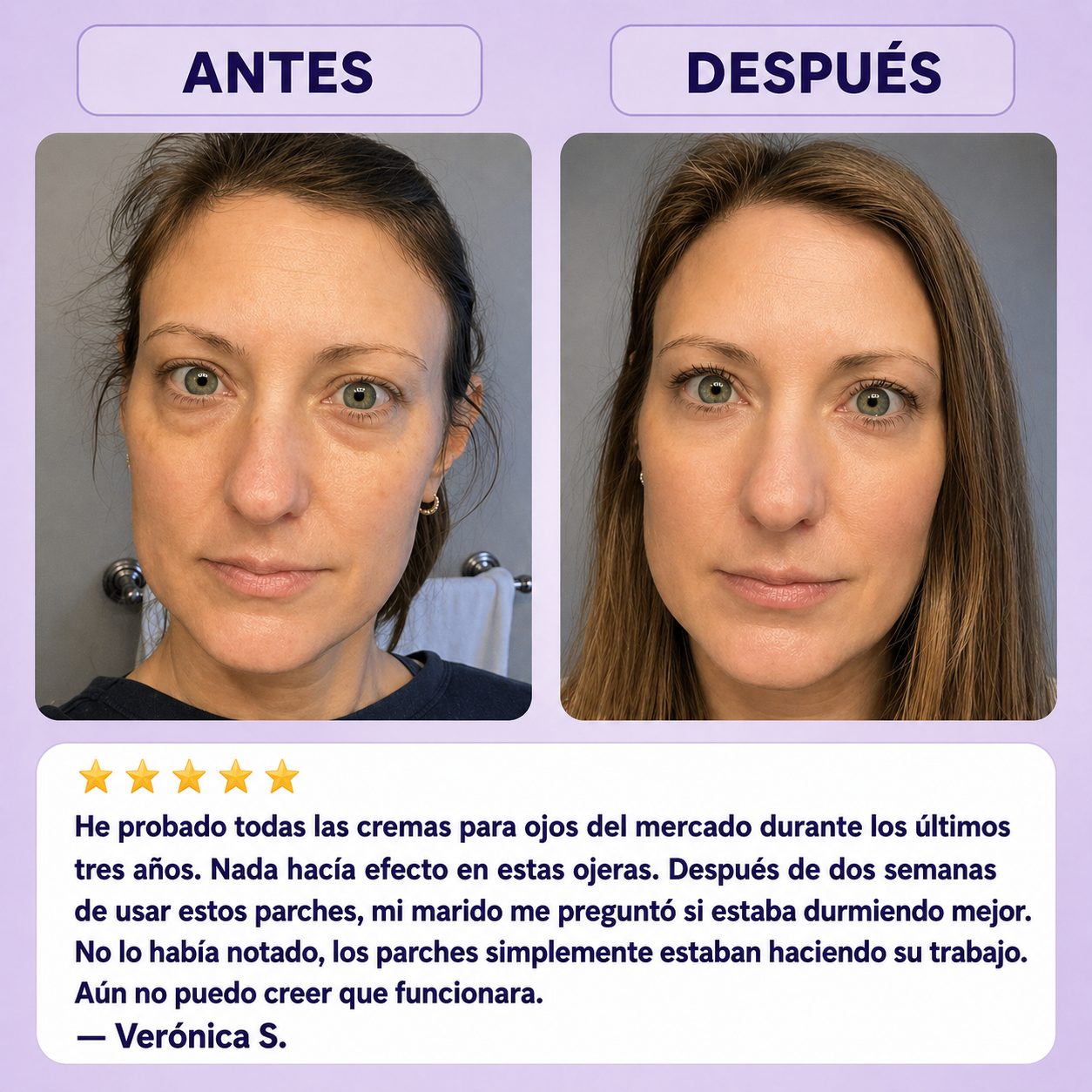 Set 2 Parches Anti-Ojeras Extras
